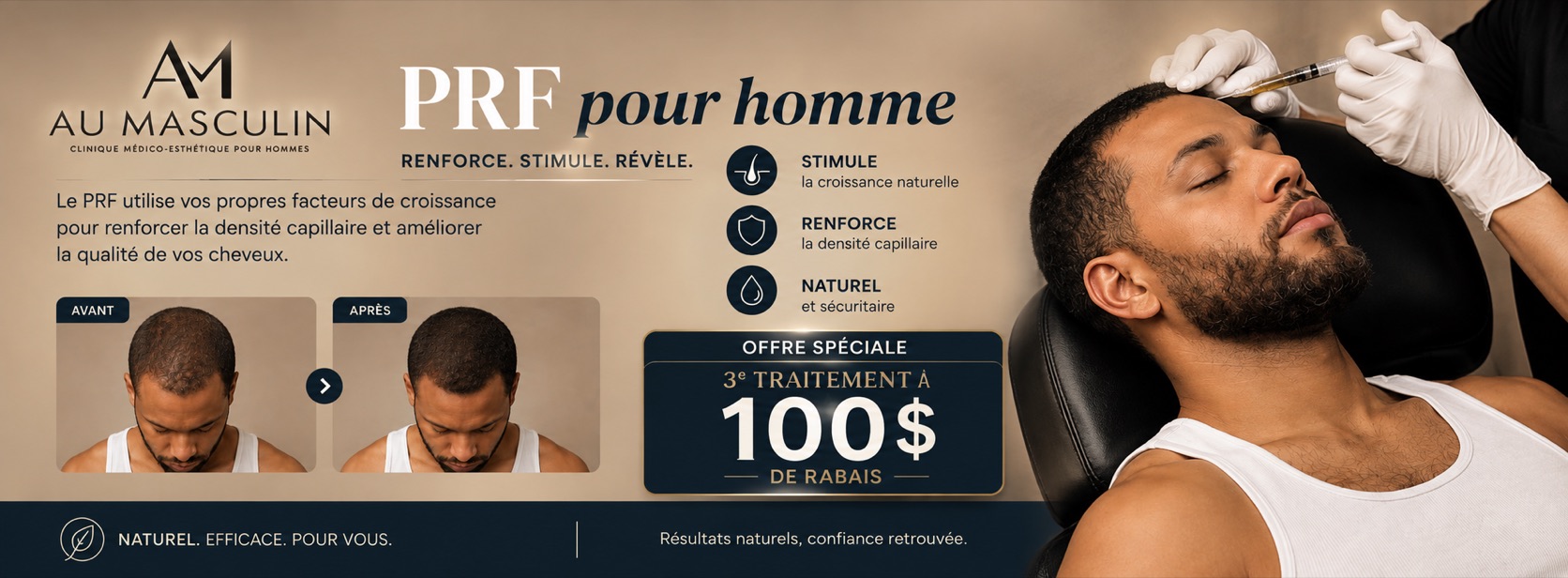 PRF pour homme — renforce, stimule, révèle : 100 $ de rabais au troisième traitement.