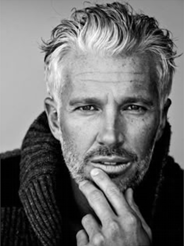 Homme aux cheveux fournis — traitement PRF capillaire